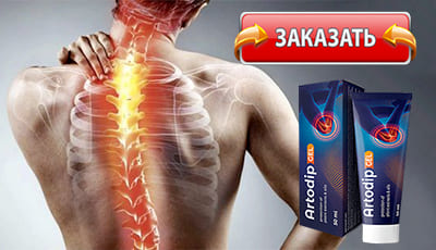Artodip gel купить в аптеке.